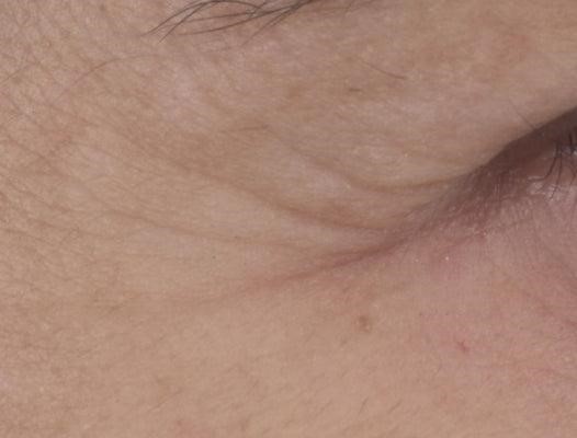 Expert Anti-Aging Κρέμα Ματιών Prin