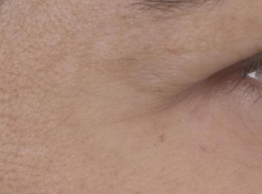 Expert Anti-Aging Κρέμα Ματιών Μετα
