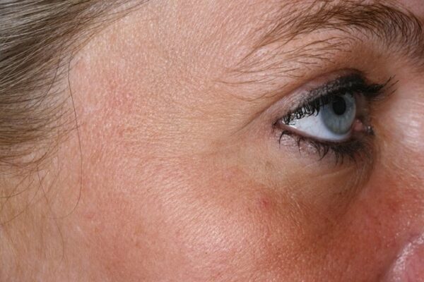 Expert Anti-Aging Κρέμα Μετά