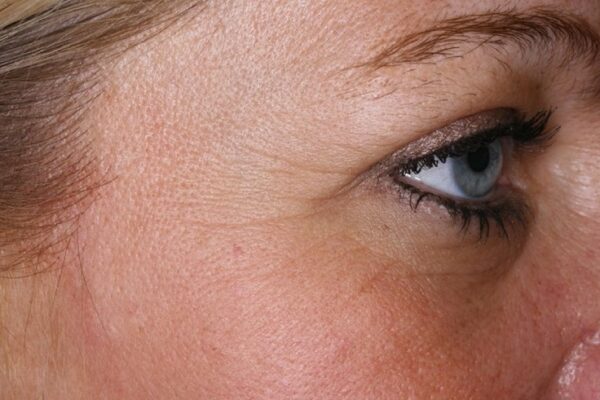 Expert Anti-Aging Κρέμα Πριν