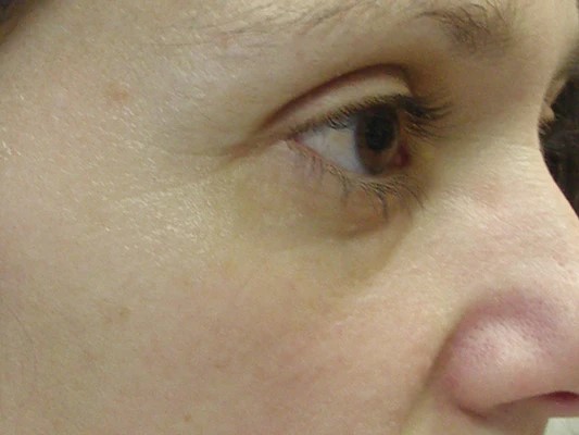 Radiance Lifting Κρέμα Ματιών Μετά