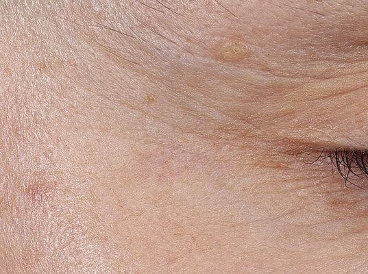 Ελαφριά κρέμα με βιταμίνη C Μετά