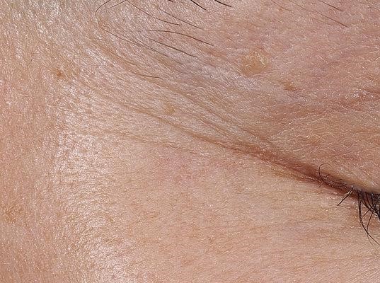 Ελαφριά κρέμα με βιταμίνη C Πριν