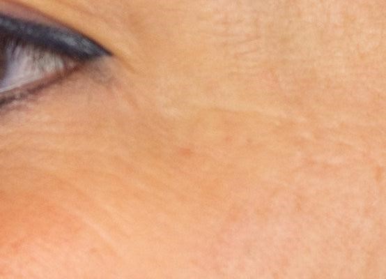 Ορός Booster με βιταμίνη C Μετά