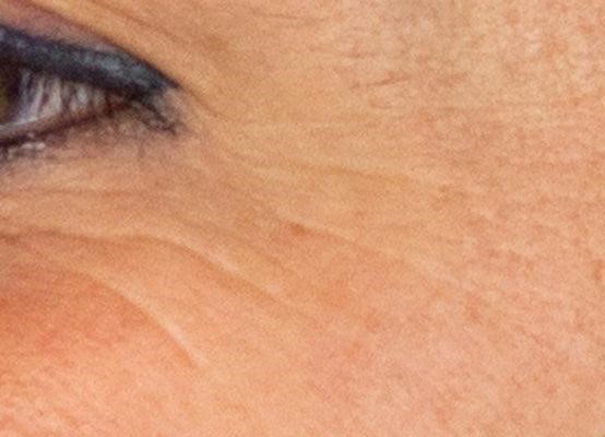 Ορός Booster με βιταμίνη C Πειν